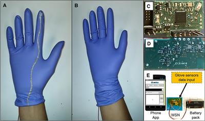 Preventing stillbirth from obstructed labor: A sensorized, low-cost device to train in safer operative birth